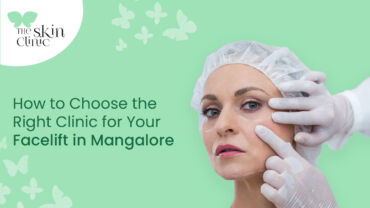 facelift in Mangalore