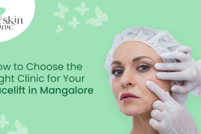 facelift in Mangalore