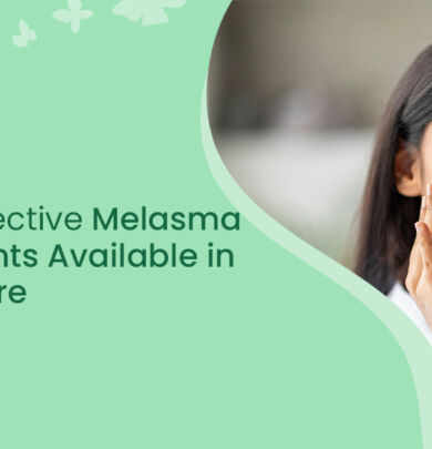 Melasma Treatments in Mangalore