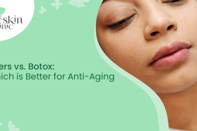 Botox vs. Filler Injections in Mangalore