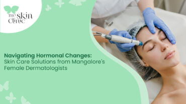 Skin Care Solutions in Mangalore