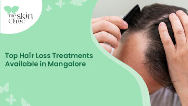 Hair Loss Treatments in Mangalore