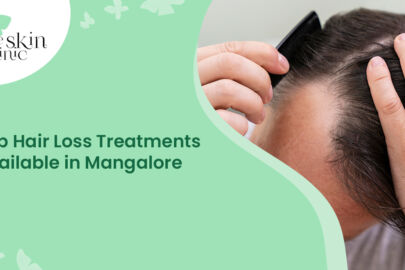 Hair Loss Treatments in Mangalore