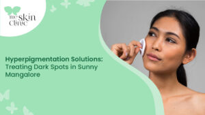 Hyperpigmentation Solutions in Mangalore