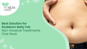 stubborn Belly Fat Treatment in Mangalore