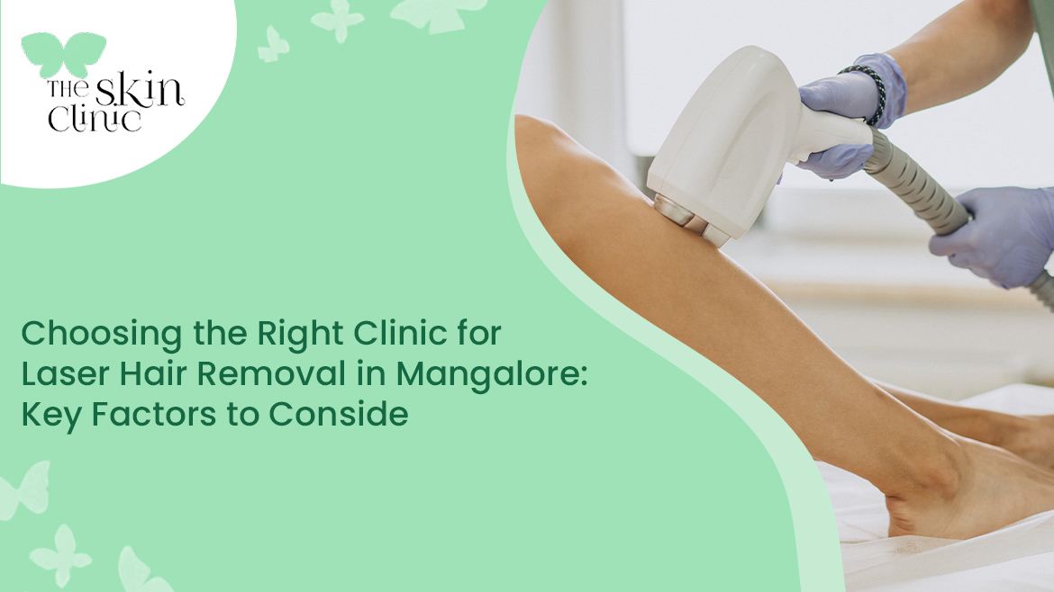 Laser Hair Removal in Mangalore